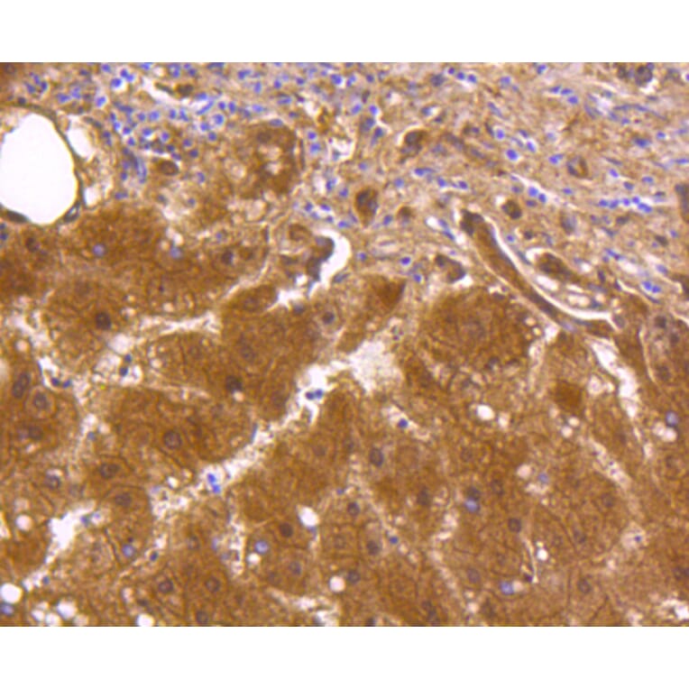 Immunohistochemistry - Anti-ALDH1A1 Antibody (A11132) - Antibodies.com
