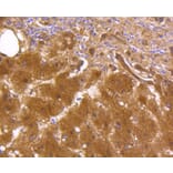 Immunohistochemistry - Anti-ALDH1A1 Antibody (A11132) - Antibodies.com