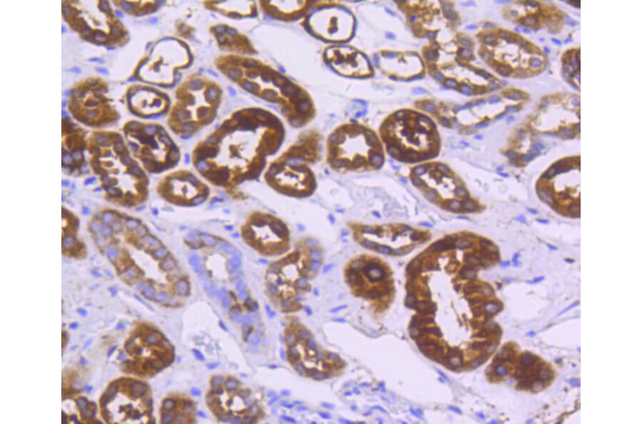 Immunohistochemistry - Anti-ALDH1A1 Antibody (A11132) - Antibodies.com