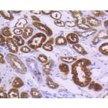 Immunohistochemistry - Anti-ALDH1A1 Antibody (A11132) - Antibodies.com