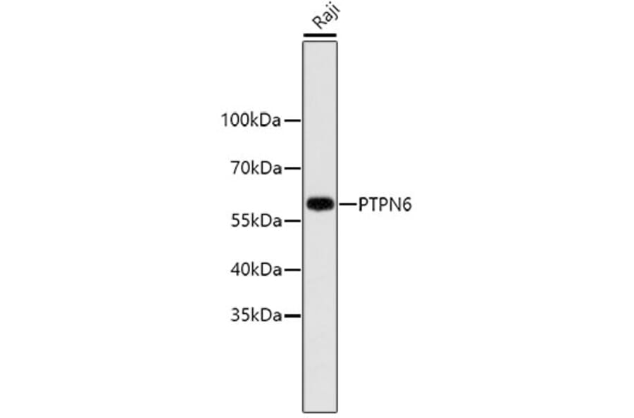 Western Blot - Anti-PTPN6 Antibody (A11134) - Antibodies.com