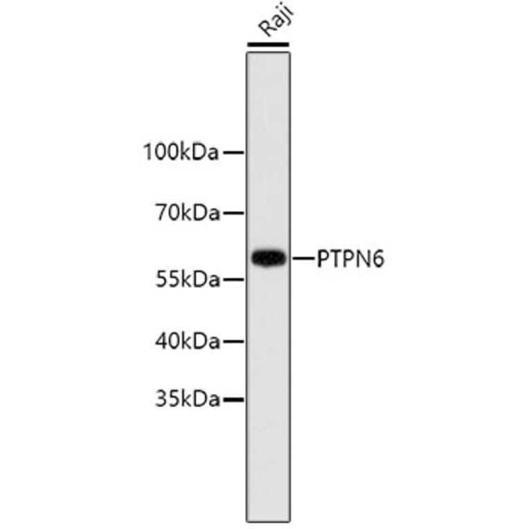 Western Blot - Anti-PTPN6 Antibody (A11134) - Antibodies.com