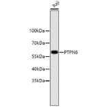 Western Blot - Anti-PTPN6 Antibody (A11134) - Antibodies.com