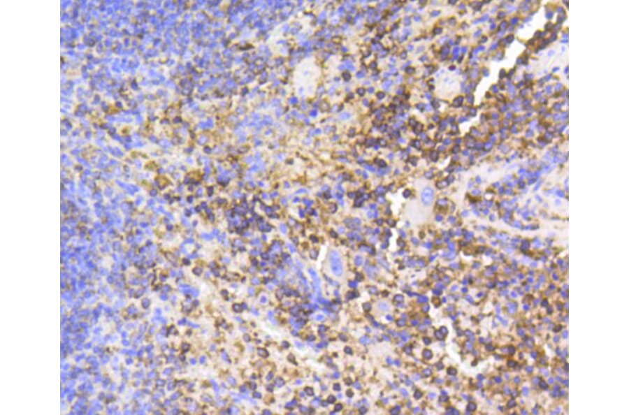 Immunohistochemistry - Anti-PTPN6 Antibody (A11134) - Antibodies.com