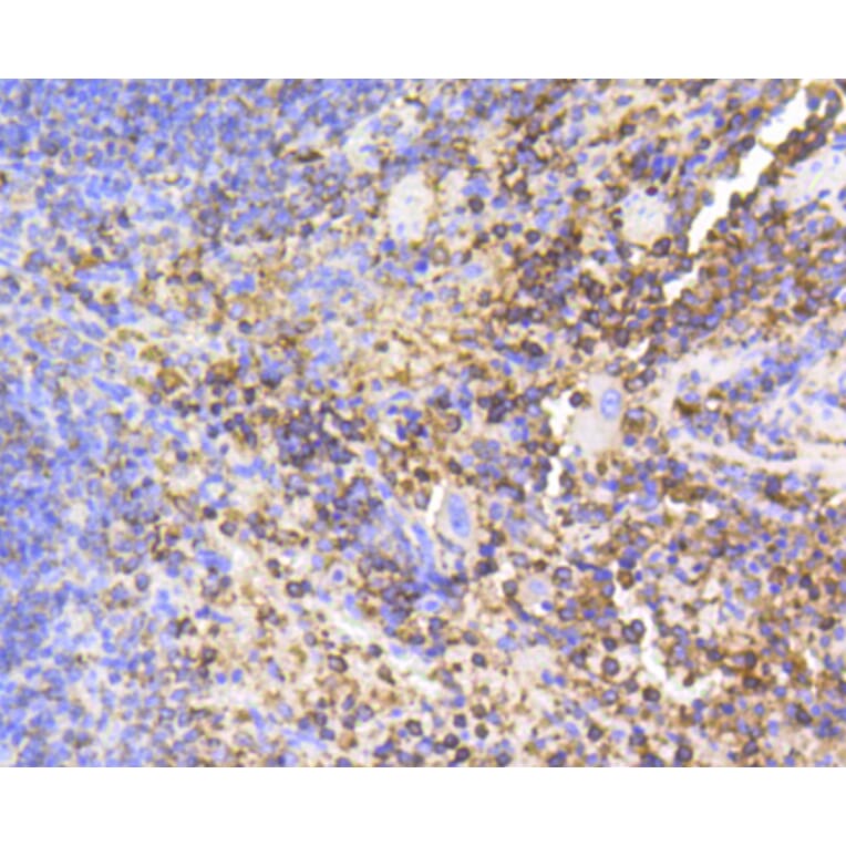 Immunohistochemistry - Anti-PTPN6 Antibody (A11134) - Antibodies.com