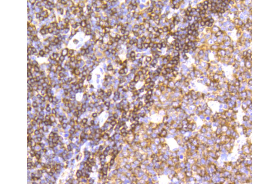 Immunohistochemistry - Anti-PTPN6 Antibody (A11134) - Antibodies.com
