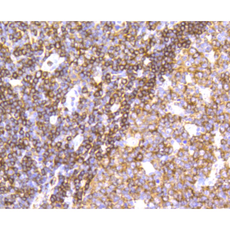 Immunohistochemistry - Anti-PTPN6 Antibody (A11134) - Antibodies.com