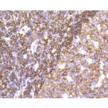Immunohistochemistry - Anti-PTPN6 Antibody (A11134) - Antibodies.com