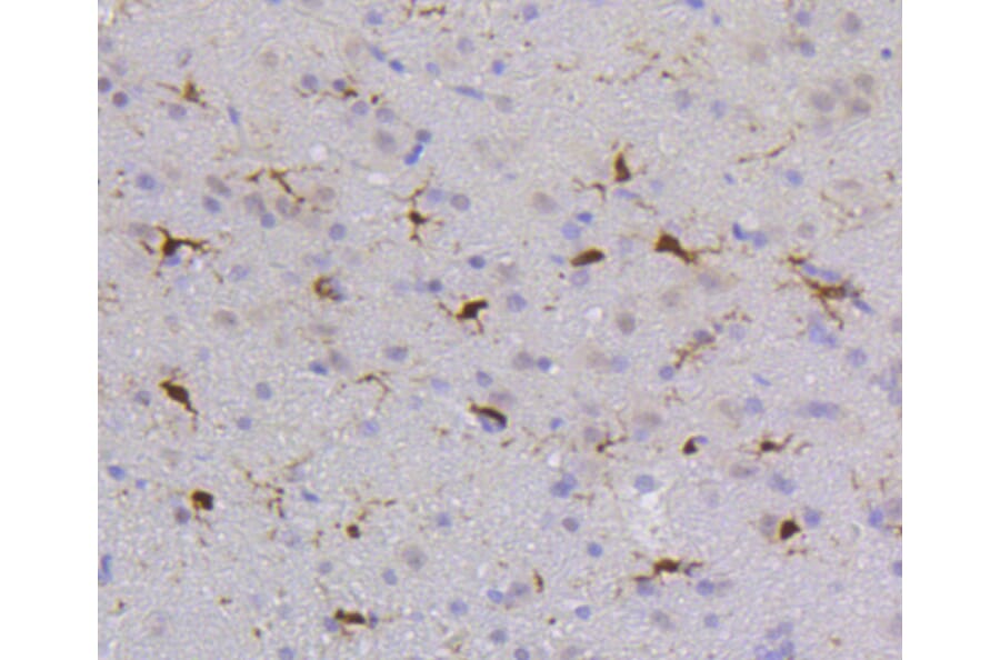 Immunohistochemistry - Anti-PTPN6 Antibody (A11134) - Antibodies.com