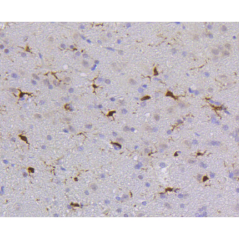 Immunohistochemistry - Anti-PTPN6 Antibody (A11134) - Antibodies.com