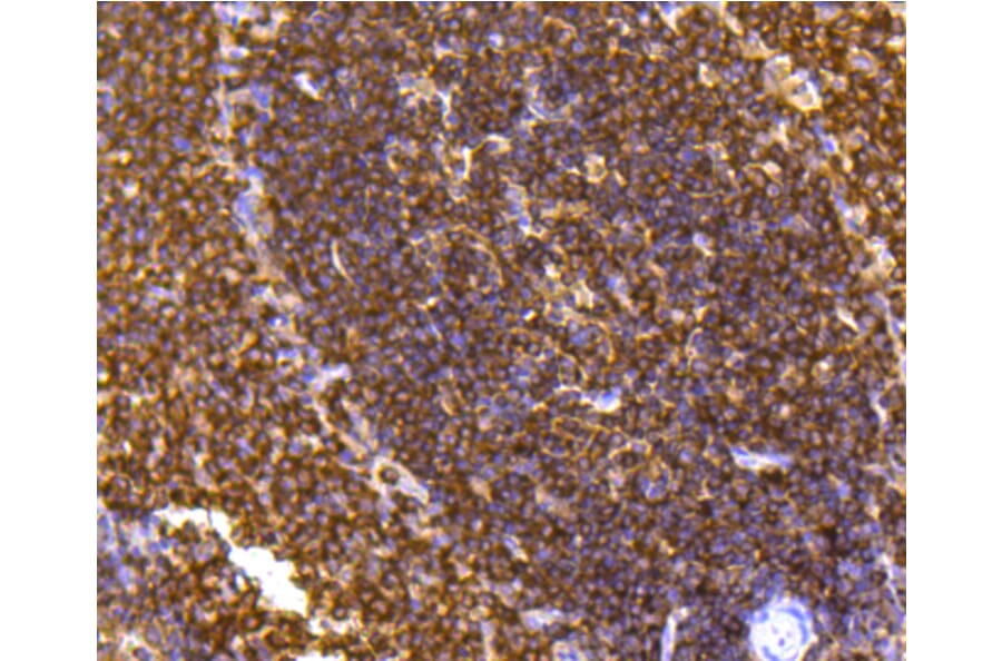 Immunohistochemistry - Anti-PTPN6 Antibody (A11134) - Antibodies.com
