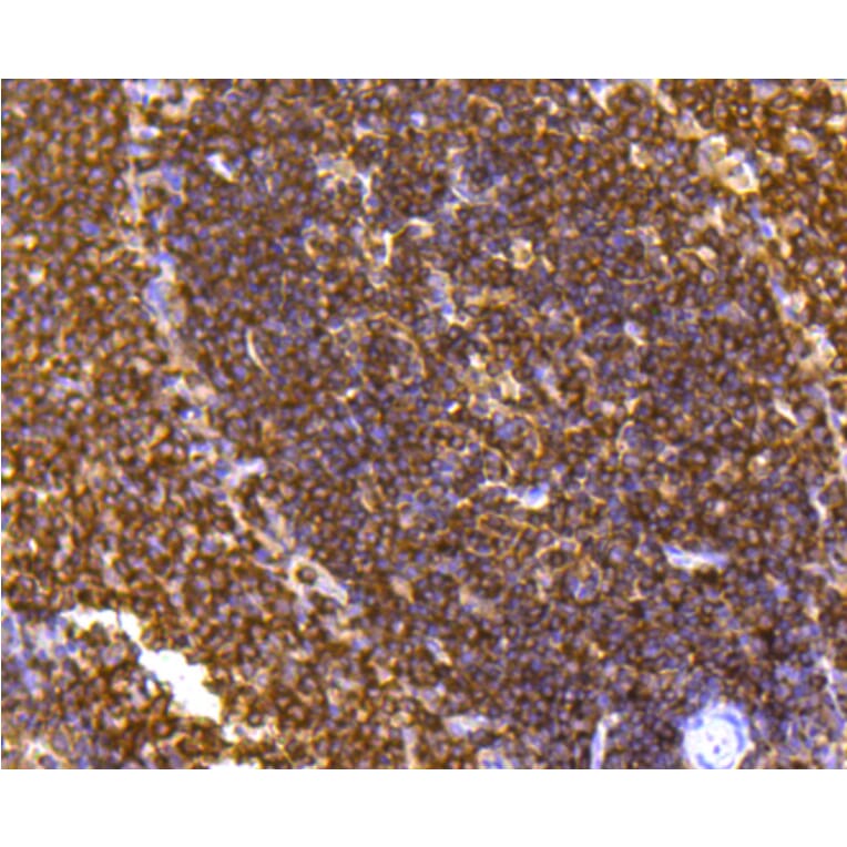 Immunohistochemistry - Anti-PTPN6 Antibody (A11134) - Antibodies.com