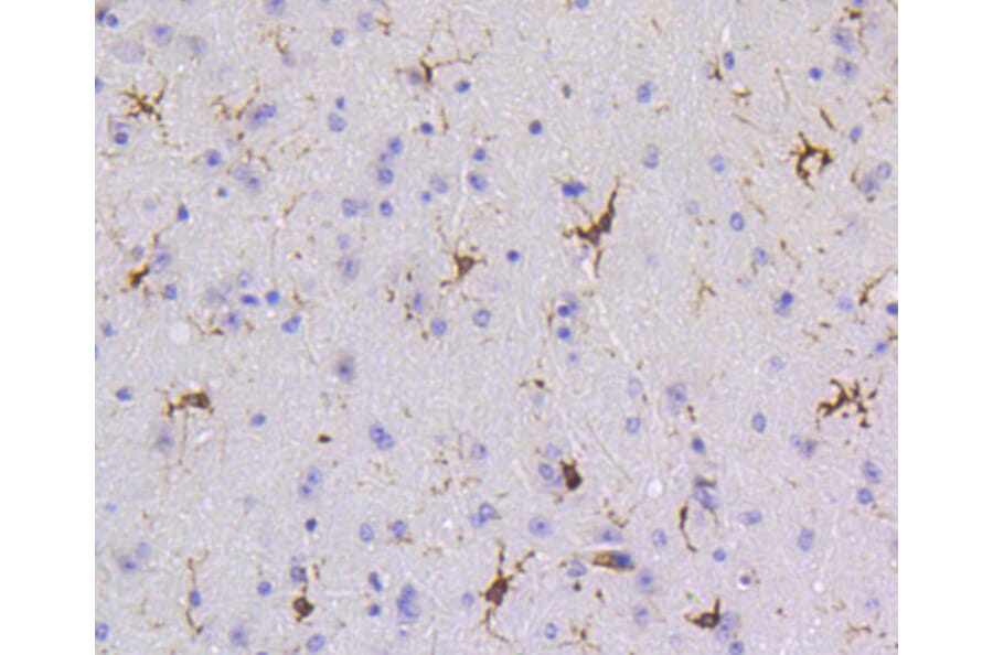 Immunohistochemistry - Anti-PTPN6 Antibody (A11134) - Antibodies.com