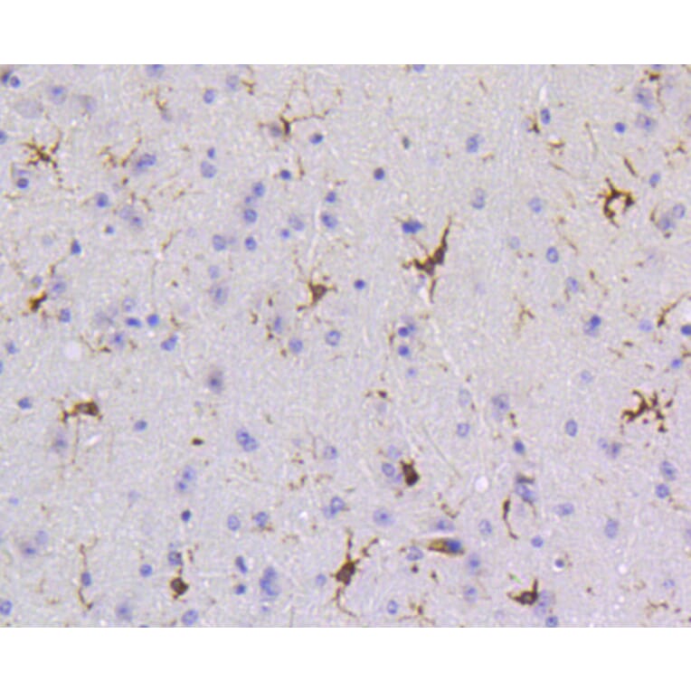 Immunohistochemistry - Anti-PTPN6 Antibody (A11134) - Antibodies.com