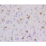 Immunohistochemistry - Anti-PTPN6 Antibody (A11134) - Antibodies.com