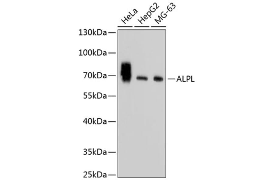 Western Blot - Anti-ALPL Antibody (A11138) - Antibodies.com