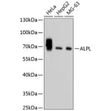 Western Blot - Anti-ALPL Antibody (A11138) - Antibodies.com