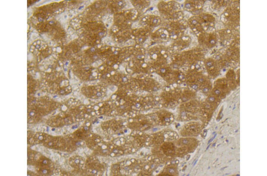 Immunohistochemistry - Anti-ALPL Antibody (A11138) - Antibodies.com