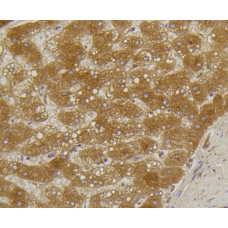 Immunohistochemistry - Anti-ALPL Antibody (A11138) - Antibodies.com