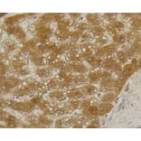 Immunohistochemistry - Anti-ALPL Antibody (A11138) - Antibodies.com
