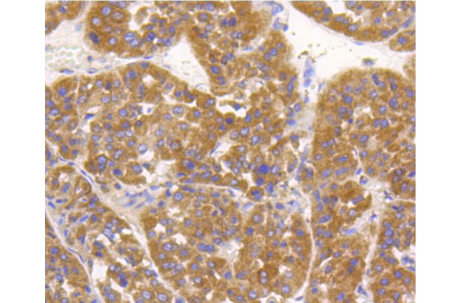 Immunohistochemistry - Anti-ALPL Antibody (A11138) - Antibodies.com