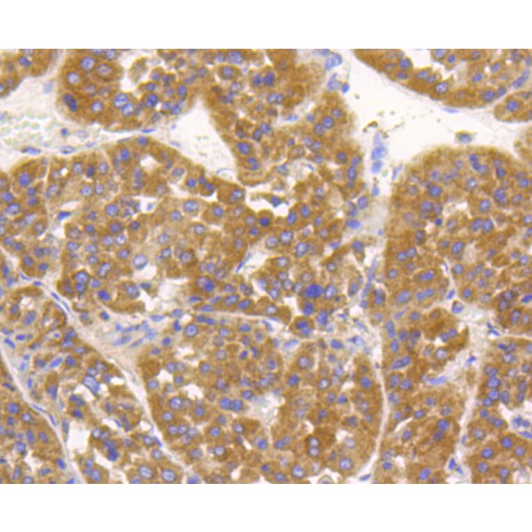 Immunohistochemistry - Anti-ALPL Antibody (A11138) - Antibodies.com