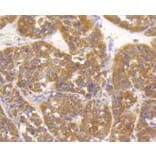 Immunohistochemistry - Anti-ALPL Antibody (A11138) - Antibodies.com