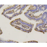 Immunohistochemistry - Anti-ALPL Antibody (A11138) - Antibodies.com