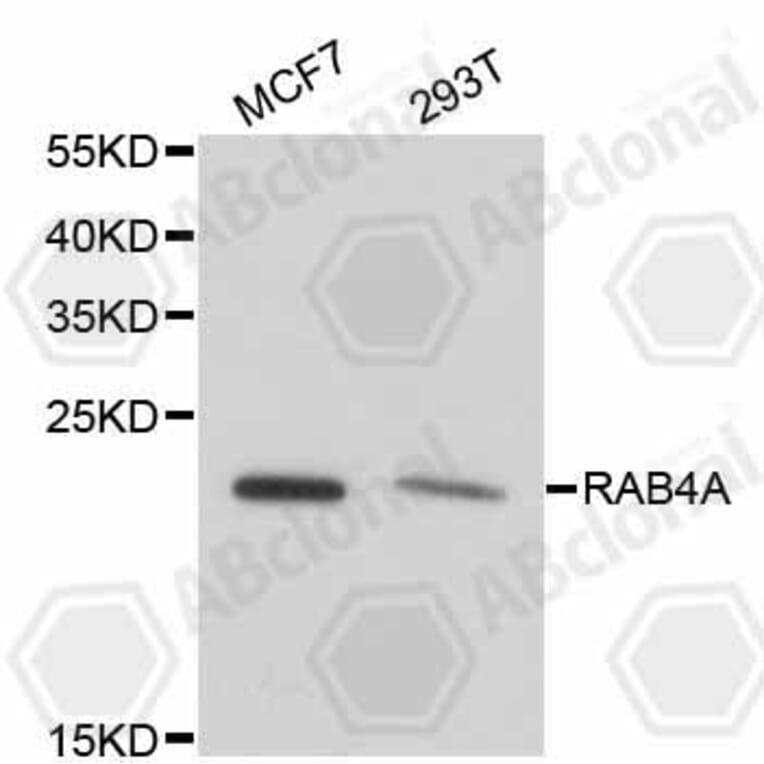 Western Blot - Anti-RAB4A Antibody (A11143) - Antibodies.com