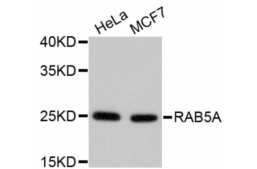 Western Blot - Anti-RAB5A Antibody (A11146) - Antibodies.com