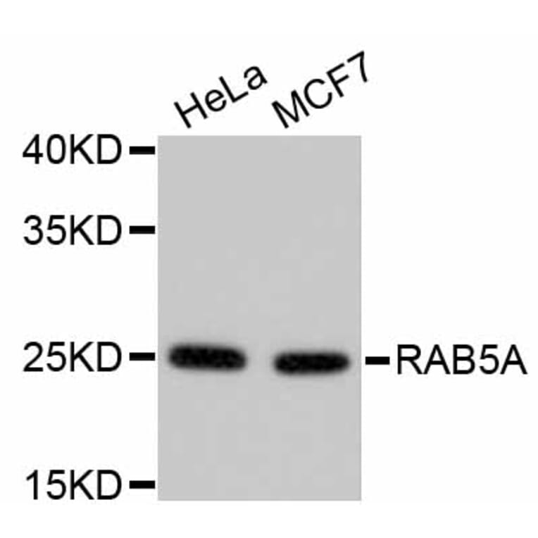 Western Blot - Anti-RAB5A Antibody (A11146) - Antibodies.com