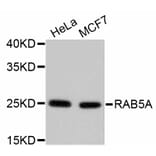 Western Blot - Anti-RAB5A Antibody (A11146) - Antibodies.com
