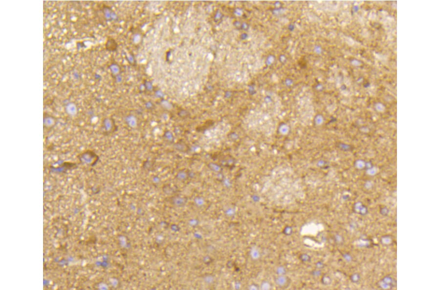 Immunohistochemistry - Anti-RAB5A Antibody (A11146) - Antibodies.com