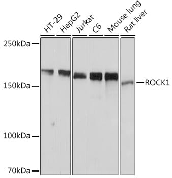 Western blot analysis of extracts of various cell lines, using Anti-ROCK1 Antibody (A11158).
Secondary antibody: Goat Anti-Rabbit IgG (H+L) (HRP) (AS014) at 1:10,000 dilution.
Lysates / proteins: 25µg per lane.
Blocking buffer: 3% non-fat dry milk in TBST.