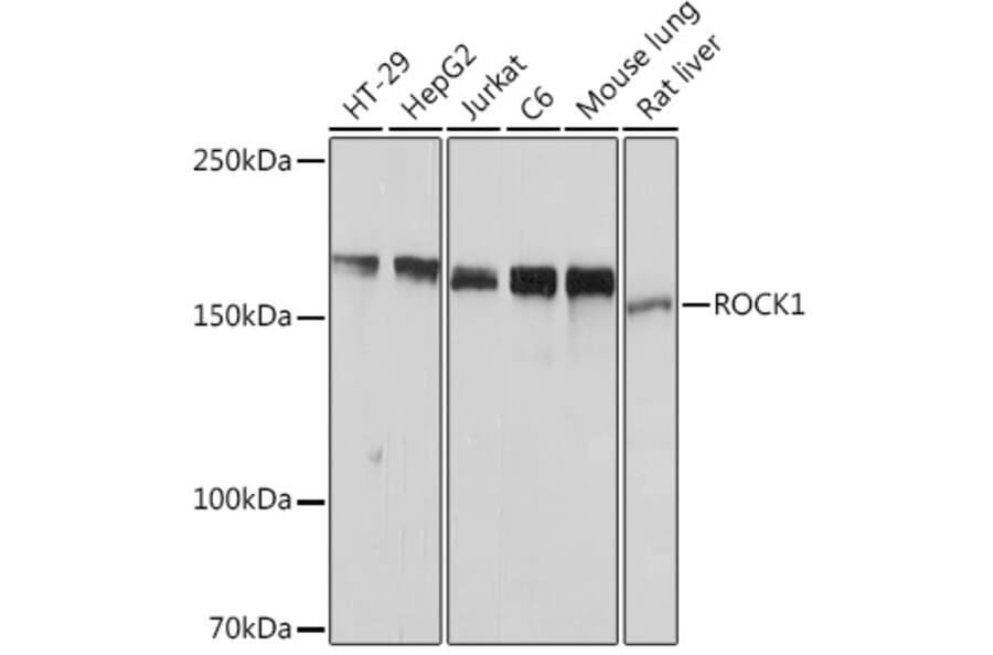 Western Blot - Anti-ROCK1 Antibody [ARC2371] (A13244) - Antibodies.com