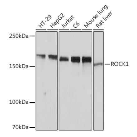 Western Blot - Anti-ROCK1 Antibody [ARC2371] (A13244) - Antibodies.com