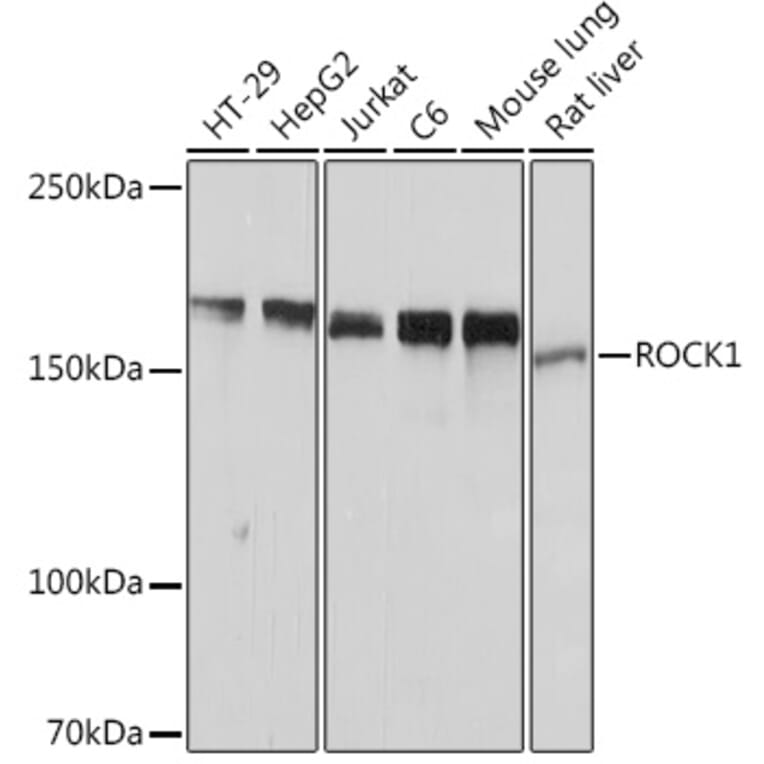 Western Blot - Anti-ROCK1 Antibody [ARC2371] (A13244) - Antibodies.com