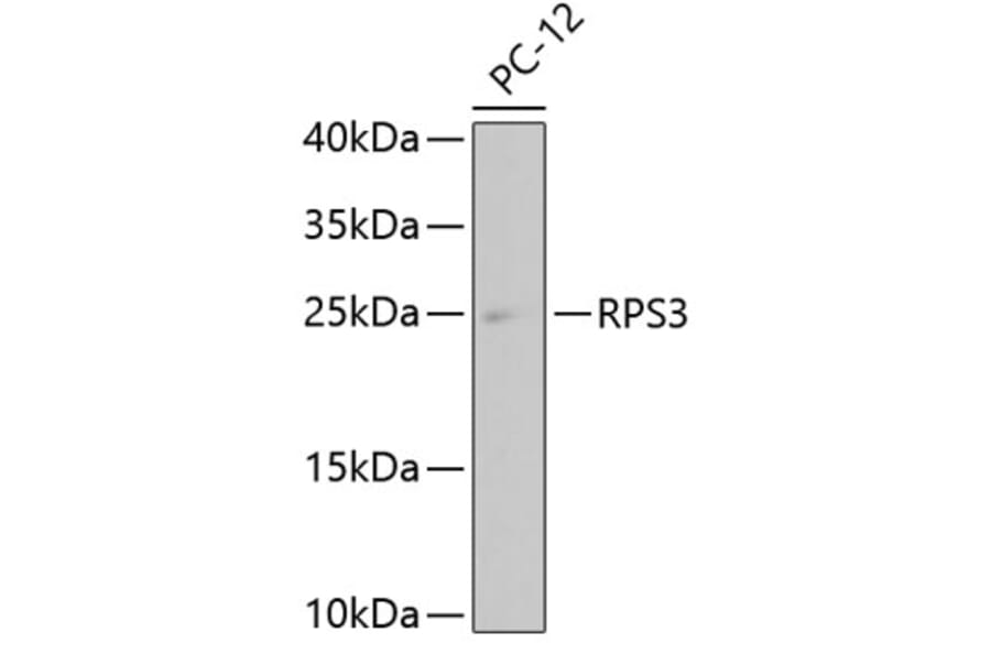 Western Blot - Anti-RPS3 Antibody (A11161) - Antibodies.com