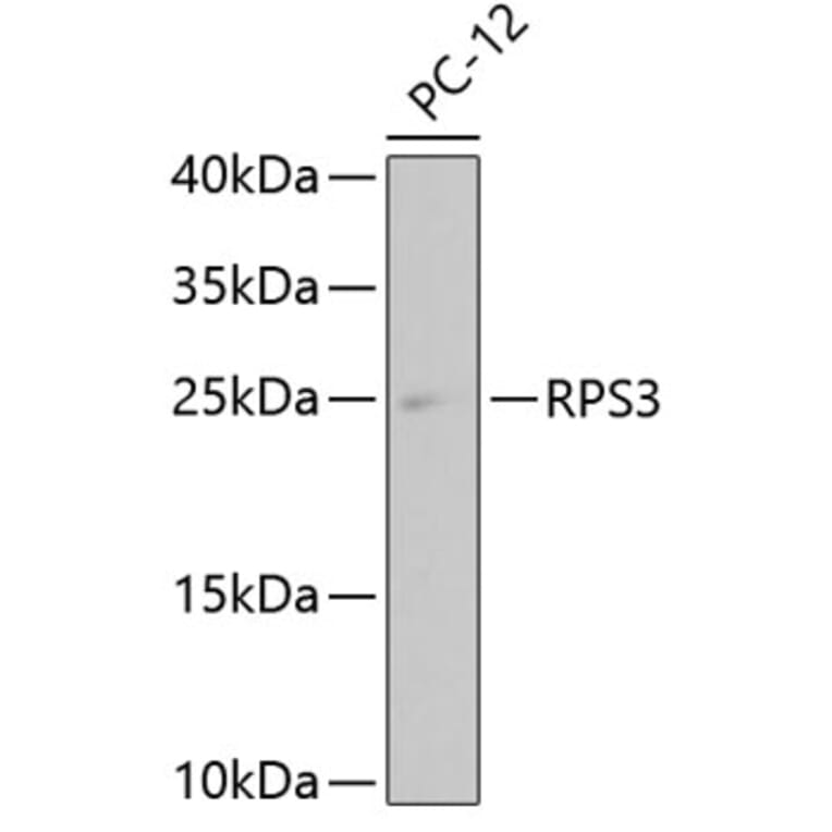 Western Blot - Anti-RPS3 Antibody (A11161) - Antibodies.com