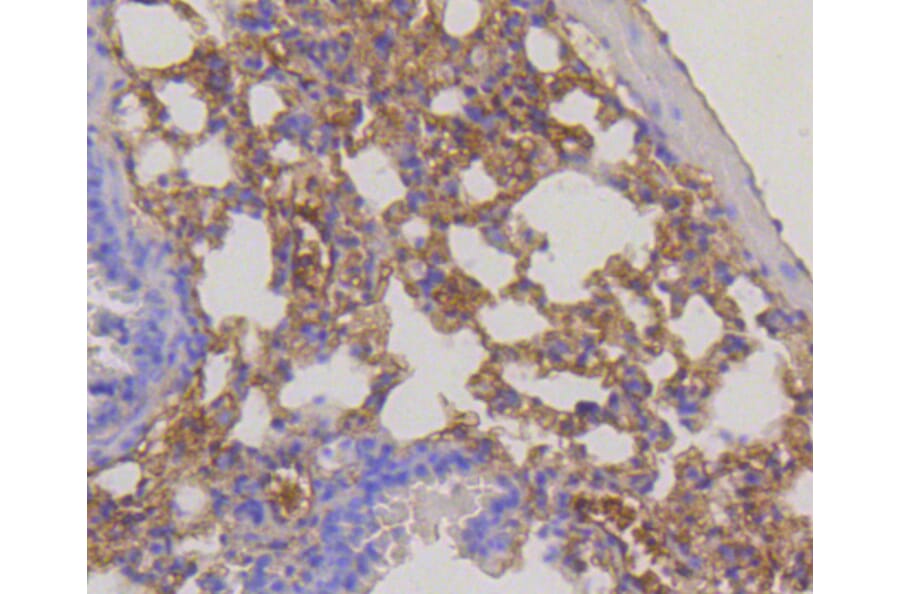 Immunohistochemistry - Anti-RPS3 Antibody (A11161) - Antibodies.com