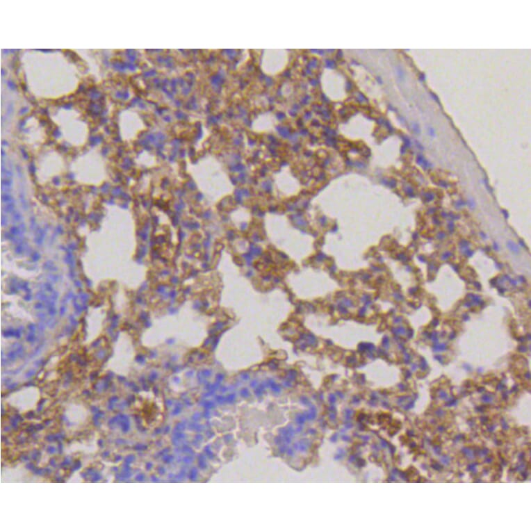 Immunohistochemistry - Anti-RPS3 Antibody (A11161) - Antibodies.com