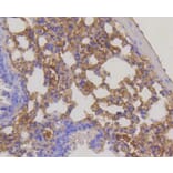 Immunohistochemistry - Anti-RPS3 Antibody (A11161) - Antibodies.com