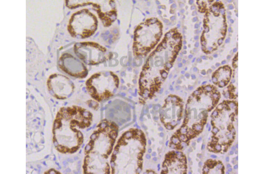 Immunohistochemistry - Anti-RPS3 Antibody (A11161) - Antibodies.com
