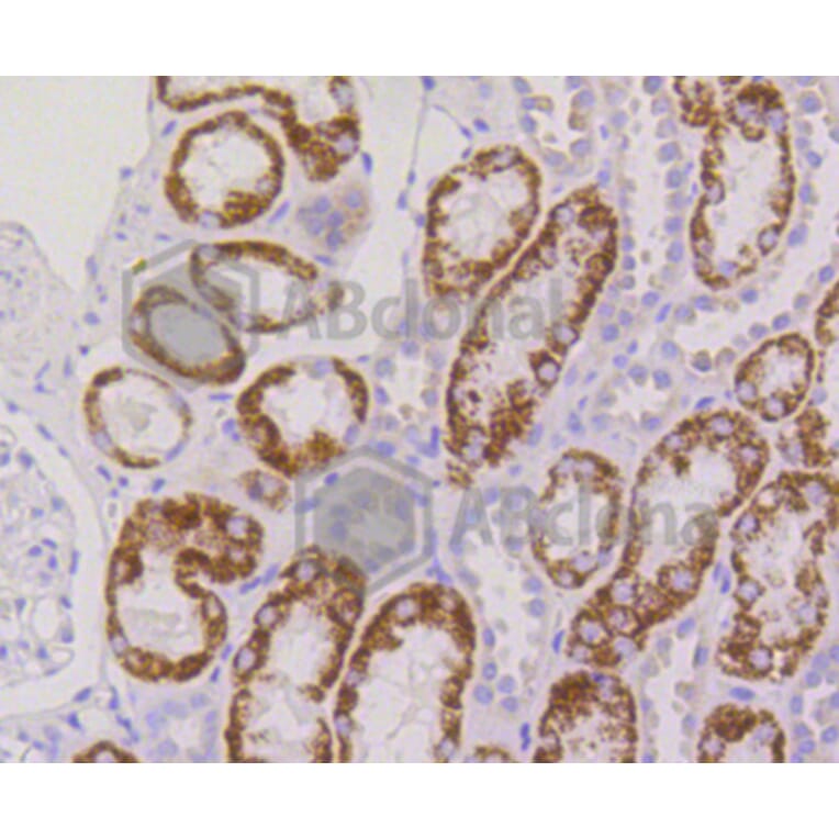 Immunohistochemistry - Anti-RPS3 Antibody (A11161) - Antibodies.com
