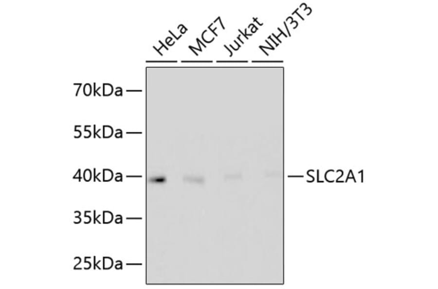 Western Blot - Anti-SLC2A1 Antibody (A11170) - Antibodies.com