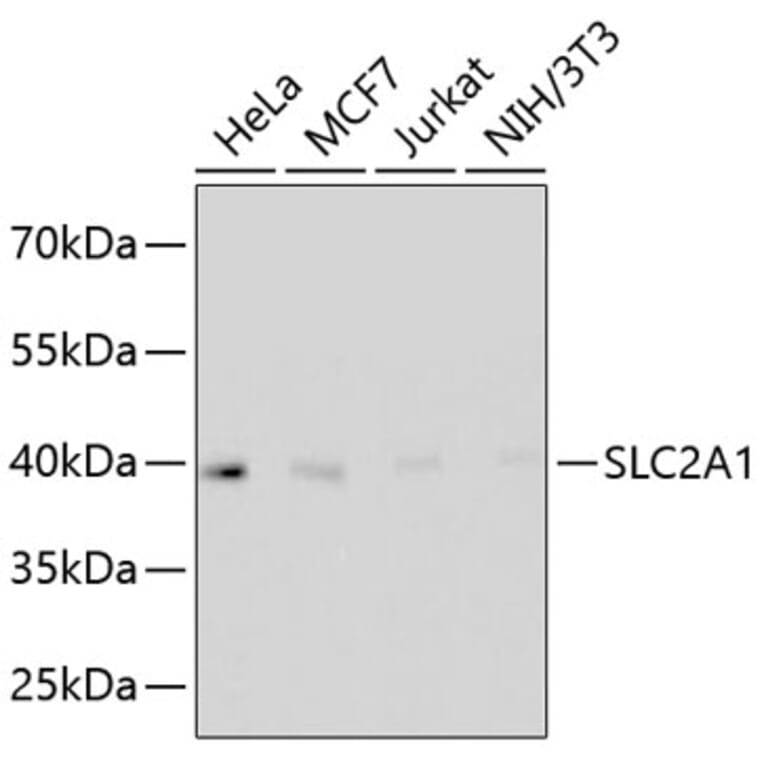 Western Blot - Anti-SLC2A1 Antibody (A11170) - Antibodies.com