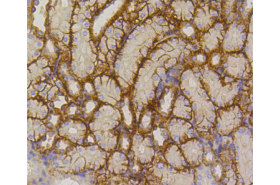 Immunohistochemistry - Anti-SLC2A1 Antibody (A11170) - Antibodies.com