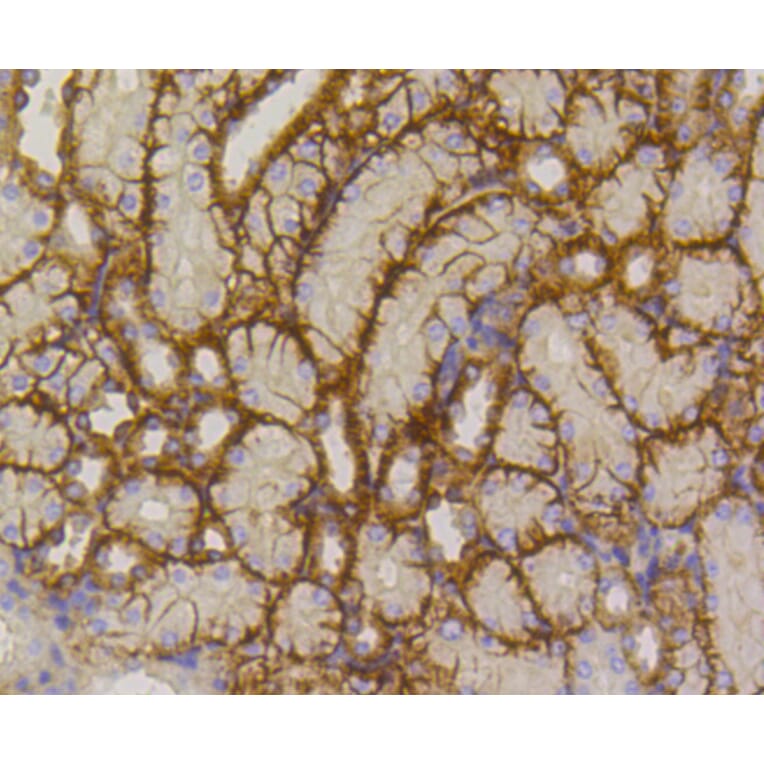 Immunohistochemistry - Anti-SLC2A1 Antibody (A11170) - Antibodies.com