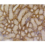 Immunohistochemistry - Anti-SLC2A1 Antibody (A11170) - Antibodies.com