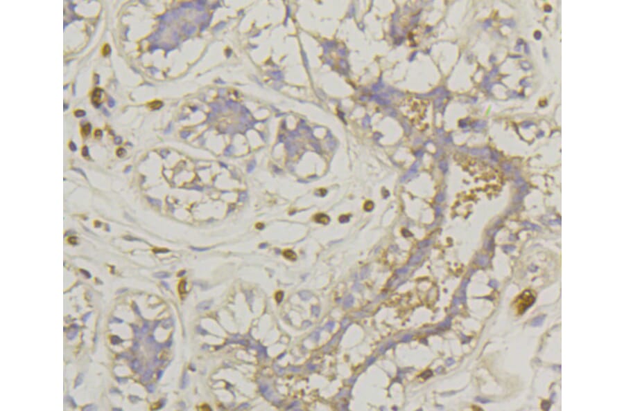 Immunohistochemistry - Anti-SLC2A1 Antibody (A11170) - Antibodies.com